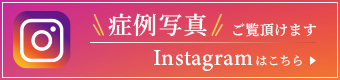 症例写真はこちらのInstagramでご覧頂けます